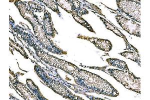 IHC analysis of Claudin18/CLDN18 using anti-Claudin18/CLDN18 antibody (ABIN7601257). (Claudin 18 Antikörper  (AA 31-261))