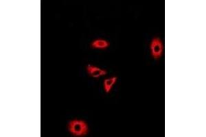 Immunofluorescent analysis of GLUD2 staining in A549 cells. (GLUD2 Antikörper)