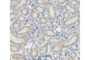 Immunohistochemistry of paraffin-embedded Rat kidney using PYCR1 Polyclonal Antibody at dilution of 1:200 (40x lens). (PYCR1 Antikörper)