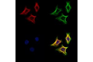 ABIN6265308 and ABIN6273168 staining Hela cells by IF/ICC. (Stanniocalcin 2 Antikörper  (C-Term))