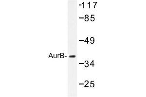 Image no. 1 for anti-Aurora Kinase B (AURKB) antibody (ABIN272108) (Aurora Kinase B Antikörper)