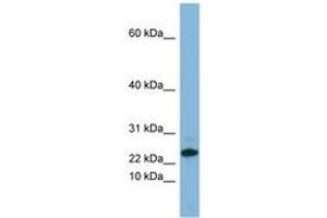 Image no. 1 for anti-Small Proline-Rich Protein 3 (SPRR3) (C-Term) antibody (ABIN6741688) (SPRR3 Antikörper  (C-Term))