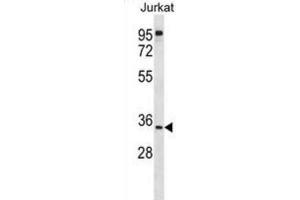 Western Blotting (WB) image for anti-UBX Domain Protein 8 (UBXN8) antibody (ABIN2998959) (UBXN8 Antikörper)