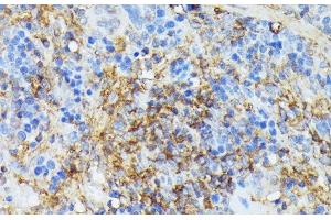 Immunohistochemistry of paraffin-embedded Rat spleen using COX15 Polyclonal Antibody at dilution of 1:100 (40x lens).