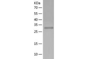 Western Blotting (WB) image for Ribosomal Protein, Large, P0 (RPLP0) (AA 2-317) protein (His tag) (ABIN7124908) (RPLP0 Protein (AA 2-317) (His tag))