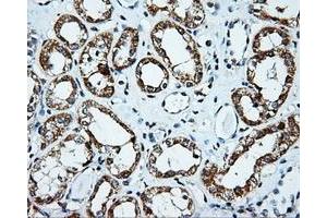 Immunohistochemical staining of paraffin-embedded Kidney tissue using anti-PLEK mouse monoclonal antibody. (Pleckstrin Antikörper)