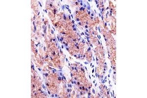 Immunohistochemistry (Paraffin-embedded Sections) (IHC (p)) image for anti-Prohibitin (PHB) (AA 1-205) antibody (ABIN1882051)
