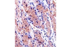 Immunohistochemical analysis of paraffin-embedded H. (Prohibitin Antikörper  (AA 1-205))