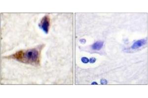 Immunohistochemistry analysis of paraffin-embedded human brain, using Caspase 1 (Phospho-Ser376) Antibody. (Caspase 1 Antikörper  (pSer376))