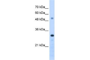 WB Suggested Anti-PSME3 Antibody Titration:  1. (PSME3 Antikörper  (C-Term))