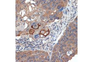 Immunohistochemistry (IHC) image for anti-Cellular Retinoic Acid Binding Protein 1 (CRABP1) antibody (ABIN7266269)