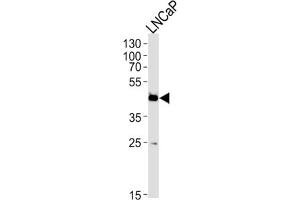 Western Blotting (WB) image for anti-Family with Sequence Similarity 54, Member A (FAM54A) antibody (ABIN3004761) (FAM54A Antikörper)