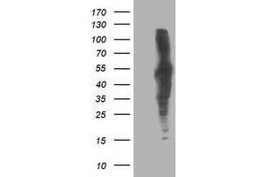 HEK293T cells were transfected with the pCMV6-ENTRY control (Left lane) or pCMV6-ENTRY DLD (Right lane) cDNA for 48 hrs and lysed. (DLD Antikörper)