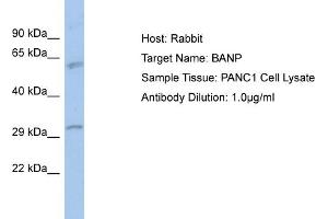 Host: Rabbit Target Name: BANP Sample Type: PANC1 Whole Cell lysates Antibody Dilution: 1.