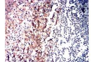 Immunohistochemistry (IHC) image for anti-Leukocyte Immunoglobulin-Like Receptor, Subfamily A (With TM Domain), Member 4 (LILRA4) (AA 24-178) antibody (ABIN7193650)
