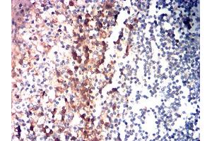 Immunohistochemical analysis of paraffin-embedded tonsil tissues using CD85G mouse mAb with DAB staining. (LILRA4 Antikörper  (AA 24-178))