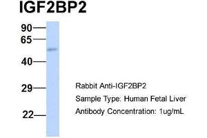 Host:  Rabbit  Target Name:  IGF2BP2  Sample Type:  Human Fetal Liver  Antibody Dilution:  1. (IGF2BP2 Antikörper  (Middle Region))
