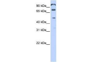 WB Suggested Anti-C10orf38 Antibody Titration:  0. (FAM171A1 Antikörper  (Middle Region))