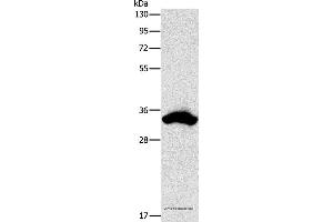 Western blot analysis of 293T cell, using CDCA8 Polyclonal Antibody at dilution of 1:900 (CDCA8 Antikörper)