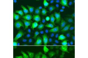 Immunofluorescence analysis of A549 cells using RRM2 Polyclonal Antibody (RRM2 Antikörper)