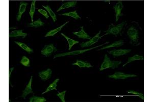 Immunofluorescence (IF) image for anti-Recoverin (RCVRN) (AA 1-200) antibody (ABIN519712)