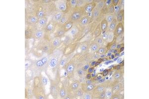Immunohistochemistry of paraffin-embedded human esophageal using ARRB1 antibody at dilution of 1:100 (400x lens). (beta Arrestin 1 Antikörper)