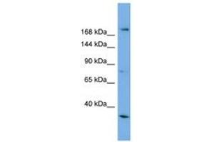 Image no. 1 for anti-Amyotrophic Lateral Sclerosis 2 (Juvenile) (ALS2) (AA 1007-1056) antibody (ABIN6743275) (ALS2 Antikörper  (AA 1007-1056))