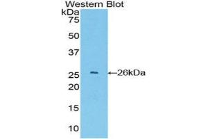 Western Blotting (WB) image for anti-Glutathione S-Transferase alpha 4 (GSTA4) (AA 1-222) antibody (ABIN1078080) (GSTA4 Antikörper  (AA 1-222))