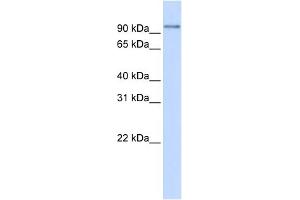 WB Suggested Anti-PDXDC1 Antibody Titration: 0. (PDXDC1 Antikörper  (N-Term))