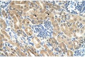 Immunohistochemical staining (Formalin-fixed paraffin-embedded sections) of human kidney with IHH polyclonal antibody  at 4-8 ug/mL working concentration. (Indian Hedgehog Antikörper  (N-Term))