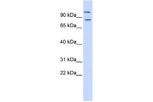 WB Suggested Anti-DAGLB Antibody Titration: 0. (DAGLB Antikörper  (Middle Region))
