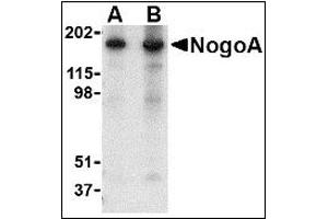 Image no. 2 for anti-Reticulon 4 (RTN4) (N-Term) antibody (ABIN372912) (Reticulon 4 Antikörper  (N-Term))