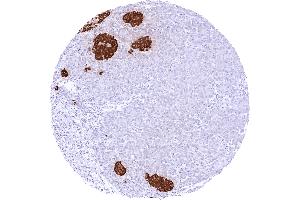 Pancreas with a strong cytoplasmic insulin staining of the majority of islet cells (Rekombinanter Insulin Antikörper)