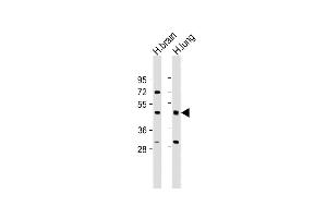 All lanes : Anti-IFT57 Antibody (Center) at 1:2000 dilution Lane 1: Human brain lysate Lane 2: Human lung lysate Lysates/proteins at 20 μg per lane. (IFT57 Antikörper  (AA 159-193))