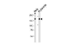 Western blot analysis of lysates from Hela cell line and human placenta tissue lysate(from left to right), using COL4A1 Antibody at 1:1000 at each lane. (COL4A1 Antikörper  (N-Term))
