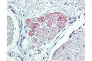 Immunohistochemistry (IHC) image for anti-Transient Receptor Potential Cation Channel, Subfamily M, Member 2 (TRPM2) (N-Term) antibody (ABIN2781840) (TRPM2 Antikörper  (N-Term))