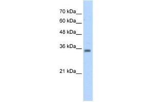 WB Suggested Anti-RASSF7 Antibody Titration:  5. (RASSF7 Antikörper  (Middle Region))