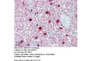 Immunohistochemistry with Human Brain, cerebellum tissue at an antibody concentration of 5. (ONECUT1 Antikörper  (Middle Region))