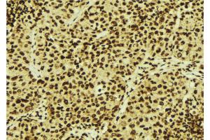 Immunohistochemistry (IHC) image for anti-CDKN2A Interacting Protein (CDKN2AIP) (Internal Region) antibody (ABIN6256870)