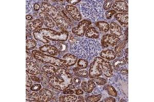 Immunohistochemical staining of human kidney with NDUFB9 polyclonal antibody  shows strong cytoplasmic positivity in cells in tubules at 1:20-1:50 dilution. (NDUFB9 Antikörper)