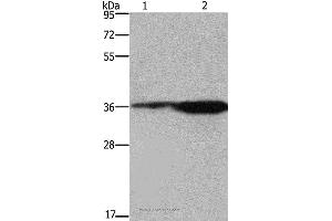 Western blot analysis of 293T cell and mouse brain tissue, using FCAR Polyclonal Antibody at dilution of 1:550 (FCAR Antikörper)
