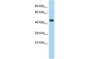 Host:  Rabbit  Target Name:  Gdap1l1  Sample Type:  Rat Kidney lysates  Antibody Dilution:  1. (GDAP1L1 Antikörper  (C-Term))