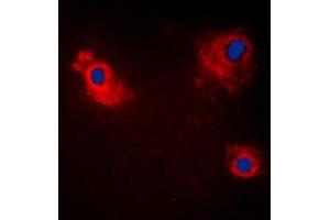 Immunofluorescent analysis of TANK staining in HeLa cells. (TANK Antikörper  (Center))