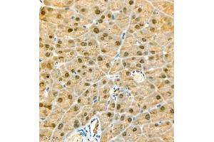 Immunohistochemistry (Paraffin-embedded Sections) (IHC (p)) image for anti-Cbp/p300-Interacting Transactivator, with Glu/Asp-Rich Carboxy-terminal Domain, 4 (CITED4) antibody (ABIN7073356)