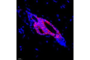 Immunofluorescence (Paraffin-embedded Sections) (IF (p)) image for anti-Keratin 13 (KRT13) (N-Term) antibody (ABIN7074412)