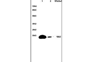 Lane 1: mouse brain lysates Lane 2: mouse heart lysates probed with Anti-phospho-BAD(Ser128) Polyclonal Antibody, Unconjugated (ABIN729478) at 1:200 in 4C.
