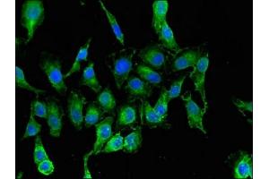 Immunofluorescent analysis of Hela cells using ABIN7144591 at dilution of 1:100 and Alexa Fluor 488-congugated AffiniPure Goat Anti-Rabbit IgG(H+L) (RARS Antikörper  (AA 201-500))