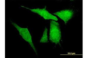 Immunofluorescence of purified MaxPab antibody to KCNIP4 on HeLa cell. (KCNIP4 Antikörper  (AA 1-250))