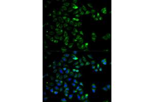 Immunofluorescence analysis of HeLa cells using HTRA2 antibody (ABIN5973384). (HTRA2 Antikörper)