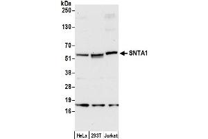 Western Blotting (WB) image for anti-Syntrophin, alpha 1 (Dystrophin-Associated Protein A1, 59kDa, Acidic Component) (SNTA1) (AA 50-100) antibody (ABIN7452974)